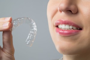 Informations sur la technique Invisalign - Orthodontie Adulte par gouttière invisible